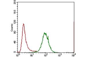 Immunohistochemical analysis of paraffin-embedded lung cancer tissues using IL3RA antibody with DAB staining. (IL3RA 抗体  (AA 200-305))