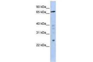 Image no. 1 for anti-Zinc Finger Protein 510 (ZNF510) (AA 611-660) antibody (ABIN6740579) (ZNF510 抗体  (AA 611-660))