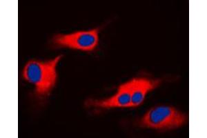 Immunofluorescent analysis of ORAOV1 staining in HeLa cells. (ORAOV1 抗体  (Center))