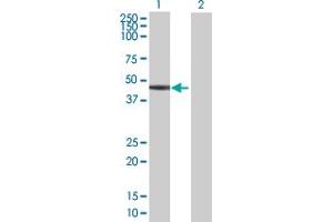 Western Blotting (WB) image for anti-serpin Peptidase Inhibitor, Clade B (Ovalbumin), Member 6 (SERPINB6) (AA 1-376) antibody (ABIN518870)
