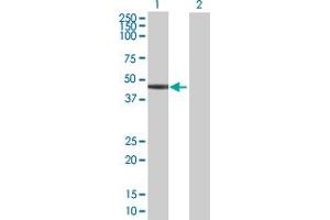 Western Blot analysis of SERPINB6 expression in transfected 293T cell line by SERPINB6 MaxPab polyclonal antibody. (SERPINB6 抗体  (AA 1-376))