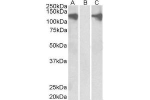 HEK293 lysate (10ug protein in RIPA buffer) overexpressing Human PUM2 with DYKDDDDK tag probed with ABIN2564820 (0. (PUM2 抗体  (Internal Region))