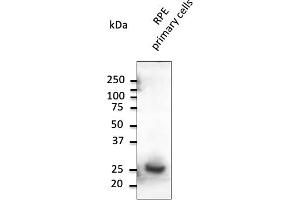Western Blotting (WB) image for anti-RAB31, Member RAS Oncogene Family (RAB31) (C-Term) antibody (ABIN6254190) (RAB31 抗体  (C-Term))