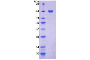 SDS-PAGE analysis of Human SSA2 Protein. (TROVE2 蛋白)