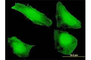 Immunofluorescence of purified MaxPab antibody to SLIC1 on HeLa cell. (SNX20 抗体  (AA 1-129))