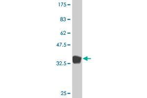 Western Blot detection against Immunogen (36. (PROS1 抗体  (AA 419-516))
