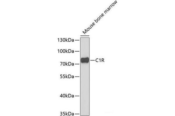 C1R 抗体