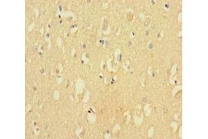 Immunohistochemistry of paraffin-embedded human brain tissue using ABIN7148873 at dilution of 1:100 (CDK2AP2 抗体  (AA 1-126))