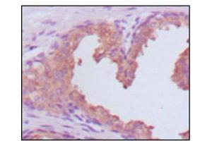 Immunohistochemistry (IHC) image for anti-Prostate Specific Antigen (PSA) (AA 26-251) antibody (ABIN2983296) (Prostate Specific Antigen 抗体  (AA 26-251))