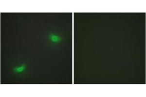 Immunofluorescence analysis of HepG2 cells, using DUSP16 antibody. (DUSP16 抗体  (C-Term))