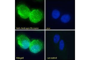 ABIN185266 Immunofluorescence analysis of paraformaldehyde fixed U2OS cells, permeabilized with 0. (Androgen Receptor 抗体  (N-Term))