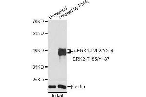 Western blot analysis of extracts of Jurkat cells, using Phospho-ERK1-T202/Y204 + ERK2-T185/Y187 antibody. (ERK1 抗体  (pThr185, pThr187, pThr202, pThr204))