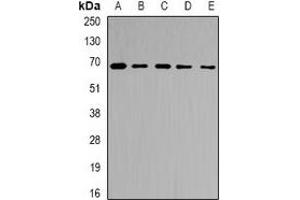 Western blot analysis of Ribophorin-2 expression in Jurkat (A), MCF7 (B), NIH3T3 (C), mouse liver (D), rat liver (E) whole cell lysates. (Ribophorin II 抗体)