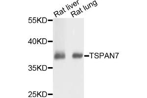 Western blot analysis of extracts of various cell lines, using TSPAN7 antibody (ABIN5973818) at 1/1000 dilution.