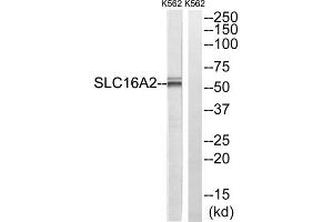 Western blot analysis of extracts from K562 cells, using SLC16A2 antibody. (SLC16A2/MCT8 抗体  (Internal Region))