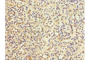 Immunohistochemistry of paraffin-embedded human spleen tissue using ABIN7158638 at dilution of 1:100 (LY75/DEC-205 抗体  (AA 440-680))