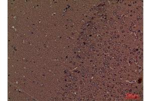 Immunohistochemistry (IHC) image for anti-serine Palmitoyltransferase, Long Chain Base Subunit 1 (SPTLC1) (C-Term) antibody (ABIN3187765)