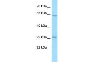 WB Suggested Anti-REEP3 Antibody Titration: 1. (REEP3 抗体  (C-Term))