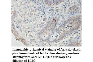Image no. 1 for anti-Akirin 2 (AKIRIN2) antibody (ABIN1574568) (AKIRIN2 抗体)