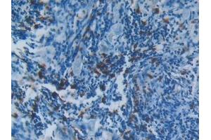 Immunohistochemistry (IHC) image for anti-S100 Calcium Binding Protein A8 (S100A8) (AA 1-93) antibody (ABIN7434062)