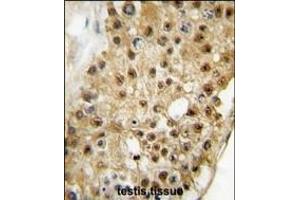 Formalin-fixed and paraffin-embedded human testis tissue reacted with ELP3 antibody (C-term) (ABIN387967 and ABIN2844715) , which was peroxidase-conjugated to the secondary antibody, followed by DAB staining. (ELP3/KAT9 抗体  (C-Term))