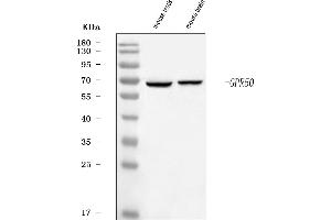 Western blot analysis of GPR50 using anti-GPR50 antibody (ABIN7600650).