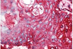 Human Skin, Pilosebaceous Unit (formalin-fixed, paraffin-embedded) stained with CD59 antibody ABIN298470 at 5 ug/ml followed by biotinylated anti-mouse IgG secondary antibody ABIN481714, alkaline phosphatase-streptavidin and chromogen. (CD59 抗体)