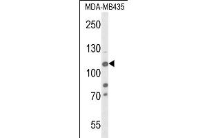 Western blot analysis of JMJD2B- (ABIN653576 and ABIN2842951) in MDA-M cell line lysates (35 μg/lane).