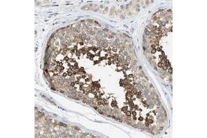 Immunohistochemical staining of human testis with KLHDC10 polyclonal antibody  shows strong cytoplasmic positivity in cells of the seminiferus ducts at 1:50-1:200 dilution. (KLHDC10 抗体)