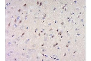 Formalin-fixed and paraffin embedded rat brain labeled with Anti-GDNFRA Polyclonal Antibody, Unconjugated  at 1:200 followed by conjugation to the secondary antibody and DAB staining. (GFRA1 抗体  (AA 351-429))
