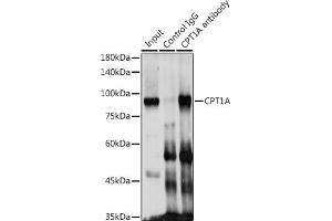 Immunofluorescence (IF) image for anti-Carnitine Palmitoyltransferase 1A (Liver) (CPT1A) (AA 497-756) antibody (ABIN6138976)