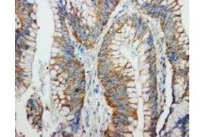 Image no. 1 for anti-Fas Ligand (TNF Superfamily, Member 6) (FASL) (C-Term) antibody (ABIN1492926) (FASL 抗体  (C-Term))
