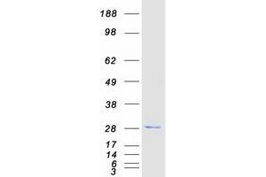 Western Blotting (WB) image for Chromosome 12 Open Reading Frame 44 (C12orf44) (Transcript Variant 1) protein (Myc-DYKDDDDK Tag) (ABIN2715024)