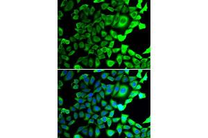 Immunofluorescence analysis of A549 cells using USP8 antibody (ABIN5974228). (USP8 抗体)
