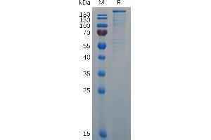 SDS-PAGE (SDS) image for Von Willebrand Factor (VWF) (AA 764-2813) protein (His tag) (ABIN7092870)