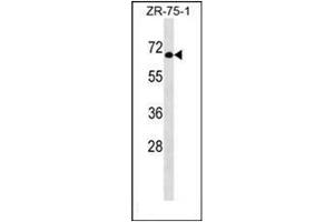 Western blot analysis of GTF3C5 Antibody (Center) in ZR-75-1 cell line lysates (35ug/lane). (GTF3C5 抗体  (Middle Region))