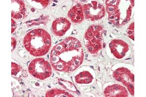 Immunohistochemistry (Paraffin-embedded Sections) (IHC (p)) image for anti-RPTOR Independent Companion of mTOR, Complex 2 (RICTOR) (AA 1650-1708), (C-Term) antibody (ABIN2627649)