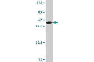 Western Blot detection against Immunogen (47. (BIN3 抗体  (AA 1-199))