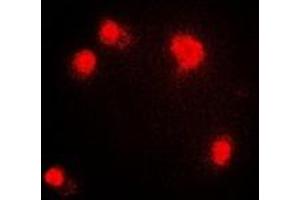 Immunofluorescent analysis of PRMT5 staining in HepG2 cells. (PRMT5 抗体)