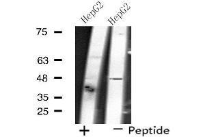 Western blot analysis of extracts from HepG2 cells, using SLC17A2 antibody. (SLC17A2 抗体  (N-Term))