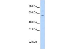 Western Blotting (WB) image for anti-Forkhead Box K1 (Foxk1) antibody (ABIN2461563) (Foxk1 抗体)