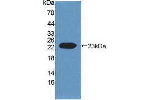 Western blot analysis of recombinant Human EFNA1. (Ephrin A1 抗体  (AA 19-182))