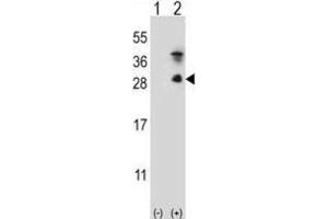 Western Blotting (WB) image for anti-Kallikrein 7 (KLK7) antibody (ABIN5022445) (Kallikrein 7 抗体)