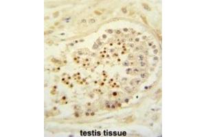 Immunohistochemistry (IHC) image for anti-Cbl Proto-Oncogene B, E3 Ubiquitin Protein Ligase (CBLB) antibody (ABIN3003861) (Cbl Proto-Oncogene B, E3 Ubiquitin Protein Ligase (CBLB) 抗体)