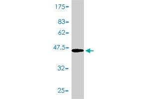 Western Blot detection against Immunogen (47. (PTGDS 抗体  (AA 1-190))