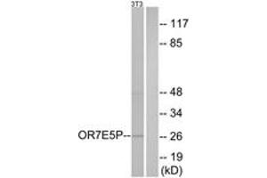 Western blot analysis of extracts from NIH-3T3 cells, using OR7E5P Antibody. (OR7E5P 抗体  (AA 35-84))