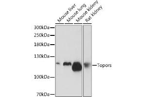 Western blot analysis of extracts of various cell lines, using Topors Rabbit pAb (ABIN7270855) at 1:1000 dilution. (TOPORS 抗体)