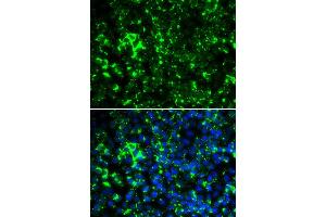 Immunofluorescence (IF) image for anti-Potassium Voltage-Gated Channel, Shaker-Related Subfamily, Member 2 (KCNA2) antibody (ABIN1980311) (KCNA2 抗体)