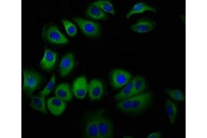 Immunofluorescence staining of A549 cells with ABIN7167453 at 1:100, counter-stained with DAPI. (STRA6 抗体  (AA 530-667))