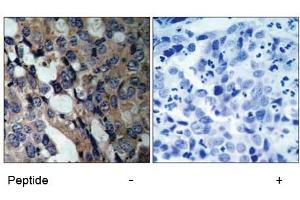 Image no. 1 for anti-Heat Shock 27kDa Protein 1 (HSPB1) (Ser15) antibody (ABIN197345) (HSP27 抗体  (Ser15))